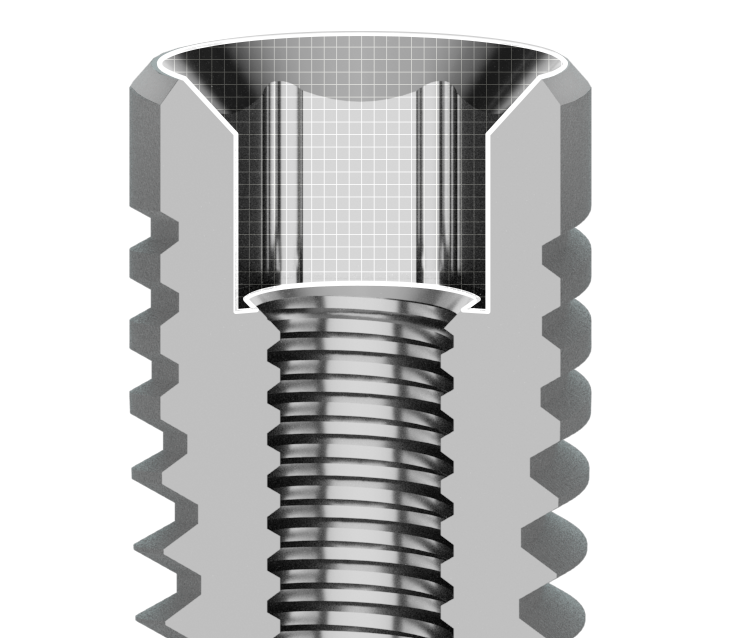 connessione-i_sezione